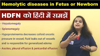 Hemolytic diseases of the Fetus and Newborn in Rh incompatibility in Hindi HDFN  Nursing Lecture [upl. by Roos]