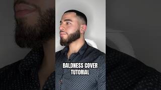 How to cover your baldness  baldness baldnesssolution haircare [upl. by Enitsej]