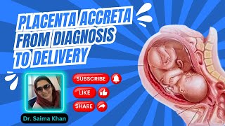 All About Placenta Accreta From Diagnosis to Delivery Doppler types healthytips DrSaimakhan [upl. by Nsaj414]