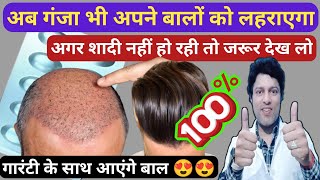 गंजे के सिर पर भी बाल ऊगा दे यह 20 रुपये वाली गोली  Best Minoxidil Tablets For Hair Fall Problem [upl. by Cannon]