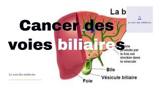 Cancer des voies biliaires [upl. by Elwyn]