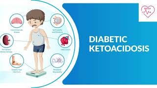 Diabetic Ketoacidosis  Endocrinology lectures  Medicine Neet pg  FMGE  Mrcp [upl. by Colene85]