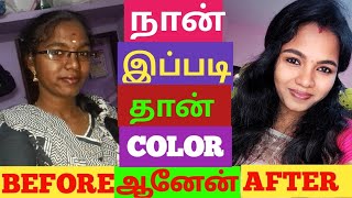 How I change my skin tone  100℅ True  Skin whitening tips  skin transformation Before amp After [upl. by Meekar]