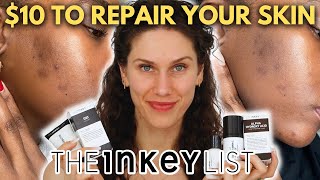 5 Best Serums From The Inkey List [upl. by Latreshia]