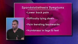 Symptoms of Spondylolisthesis [upl. by Godderd]