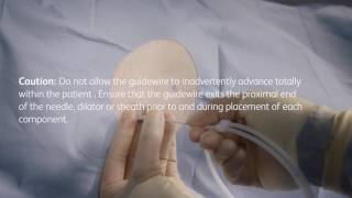 PleurX® pleural catheter placement video [upl. by Perusse]