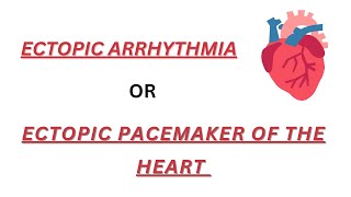 Ectopic pacemaker of heart  ectopic arrhythmia [upl. by Ivory]