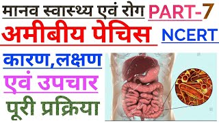 अमीबिएसिस या अमीबीय पेचिश।। What is amoebiasis or amoebic dysentery in Hindi Biology [upl. by Teodoro]