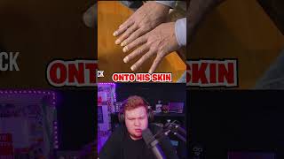 Why This Man’s Skin Turned Blue [upl. by Einnor]