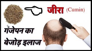 गंजेपन को रामबाण इलाज  काला जीरा  Baldness and Hair Loss Remedies Using Black Cumin Jeera [upl. by Derej]