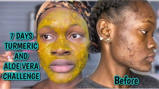 TURMERIC and ALOE VERA for 7 days  how to get rid of dark spots and pigmentation EFFECTIVELY [upl. by Elohcan]