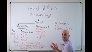 Petechial Rash  Approach [upl. by Cence]