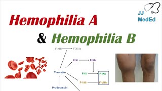 Hemophilia A vs Hemophilia B  Genetics Symptoms and Treatment [upl. by Claudia794]