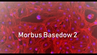 Der Morbus Basedow Teil 2 [upl. by Asselem]