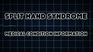 Split hand syndrome Medical Condition [upl. by Inattyrb]