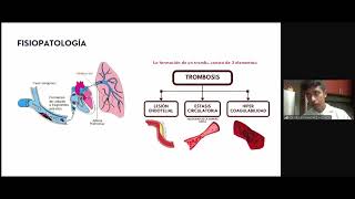 TROMBOEMBOLISMO PULMONAR TEP [upl. by Anile]