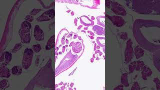 Two lungworm species in one lung histopathology pathology science [upl. by Anav]