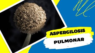 Aspergilosis Pulmonar un hongo invasivo [upl. by Ariek]