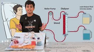 Hemodialysis A LifeSaving Treatment for Kidney Failure [upl. by Eenat]