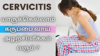 CERVICITIS TREATMENT யாருக்கெல்லாம் கருப்பை வாய் அழற்சிவீக்கம் வரும் [upl. by Batsheva230]