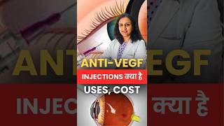 आँखों के AntiVEGF injections क्या हैं   Know USES and COST Clio Eye Care [upl. by Pyne]