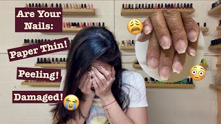 Acrylics damaged my nails How to bring damaged Nails back to health [upl. by Michelina]