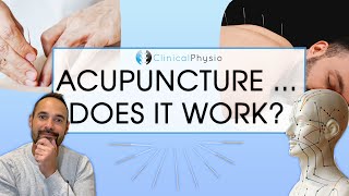 Does Acupuncture Work in Physiotherapy  Expert Physio Reviews the Evidence [upl. by Seema]