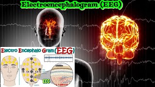 Electroencephalography EEG  How Electroencephalogram test works  What conditions can EEG diagnos [upl. by Anair]