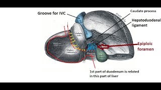 Epiploic foramen  easy and brief description [upl. by Aicertap]