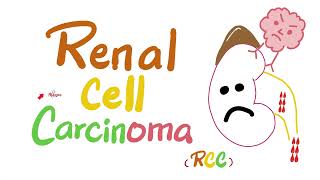 Renal Cell Carcinoma RCC  Kidney Tumors  Neoplasms  Renal Pathology  Nephrology [upl. by Alyakcim905]