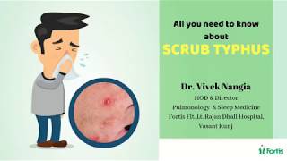 All about SCRUB TYPHUS  Dr Vivek Nangia [upl. by Ibok470]