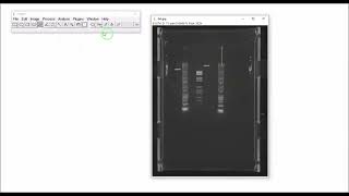 Mesure des distances de migration sur gel délectrophorèse avec ImageJ [upl. by Philbert]