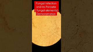 Fungal infection and its parasite Demonstration [upl. by Bethezel]