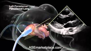 How to do a Basic Transthoracic Echocardiogram Transducer Position and Anatomy [upl. by Martinez]