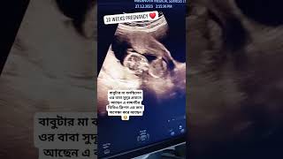 16 Weeks Pregnancy Ultrasonogram  ১৬ সপ্তাহের আলট্রাসোনোগ্রাম কেমন হয় ultrasound pregnancyscan [upl. by Elleynod]