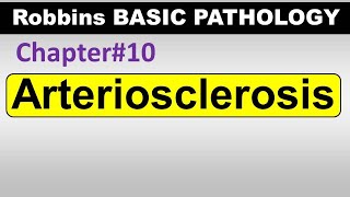 Ch10  Arteriosclerosis  Blood Vessel Pathology  Robbins Lectures [upl. by Frankel]