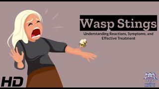 Wasp Stings Your Ultimate Guide to Reactions and Relief [upl. by Ytomit]