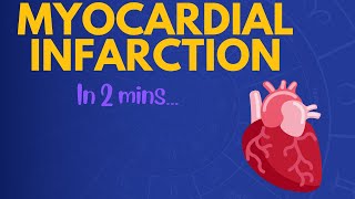 Myocardial Infarction in 2 mins [upl. by Zora]