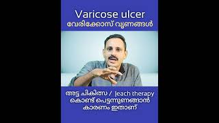 Leach therapy ഗുണങ്ങൾ [upl. by Sandra]