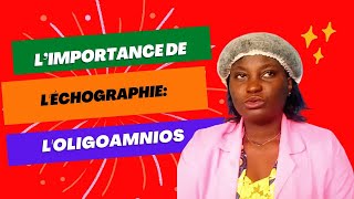 Léchographie loligoamnios [upl. by Irehc]