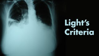 Lights Criteria amp Pleural Effusions  MEDZCOOL [upl. by Byrd]