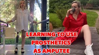 Amputee woman  adaptive prosthetic leg user  learning how to use [upl. by Derdle73]