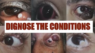 PATHOLOGICAL EYE CONDITIONS 1 Ophthalmology Osce [upl. by Astrix153]