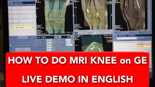 Knee Joint MRI scan protocol positioning and planning on GE 15 Tesla  Live Demo in English [upl. by Nadnarb302]