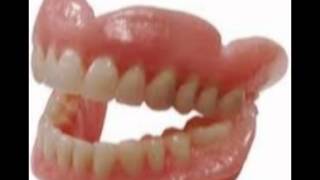 Cork 96FM Wind Up Drunk Man loses False Teeth in Cork Con Bar [upl. by Dalohcin]