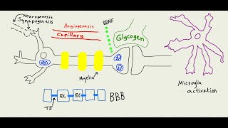 Is there any hope for memory loss amp dementia patients [upl. by Adnah]