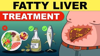 Fatty Liver Treatment  Fatty Liver Diet  Liver Detox  Fatty Liver  Fatty Liver Symptoms [upl. by Fink]