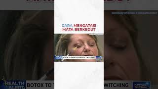 CARA MENGATASI MATA BERKEDUT blepharospasm botox [upl. by Faux689]