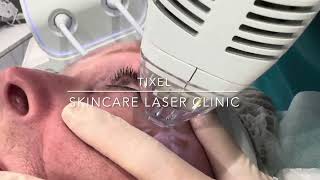 TIXEL  SKINCARE LASER CLINIC  POINTCOOK  MELBOURNE [upl. by Seravat]