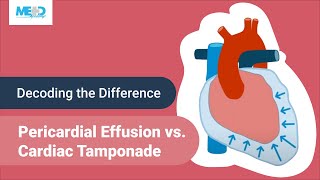 Decoding the Difference Pericardial Effusion vs Cardiac Tamponade [upl. by Lodi]